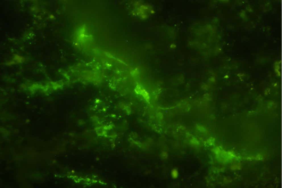 العثور على ميكروبات حية في أعماق صخرة عمرها ملياري عام العثور على ميكروبات حية في أعماق صخرة عمرها ملياري عام