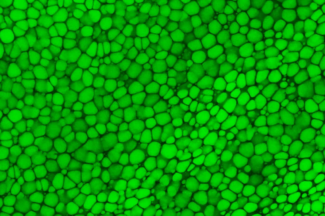 أذنيك وأنفك مصنوعان من أنسجة تشبه غلاف الفقاعات